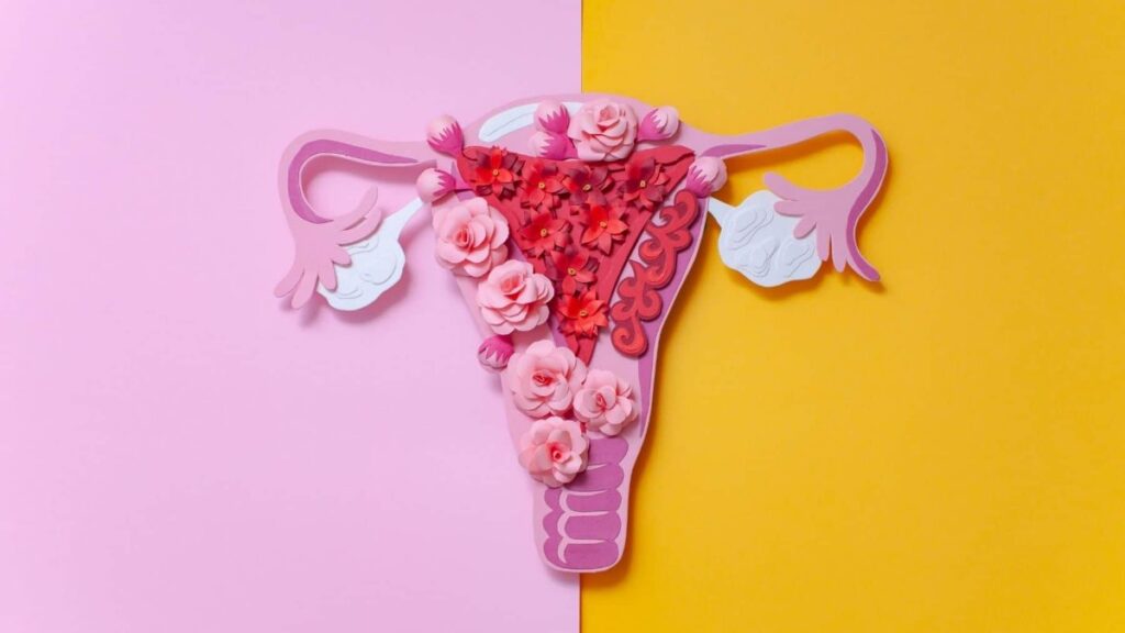 ¿Puede causar infertilidad la endometriosis?